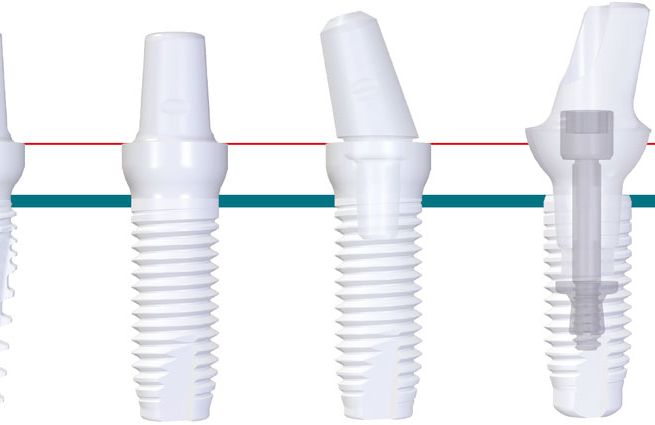 ジルコニアインプラント